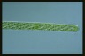 Spirogyra