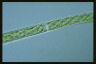 Spirogyra