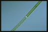 Spirogyra