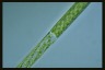 Spirogyra