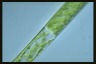 Spirogyra