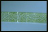 Spirogyra