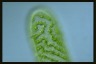 Spirogyra