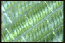 Spirogyra