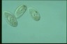 Paramecium