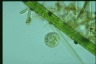 Choanocystis