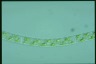 Spirogyra