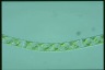 Spirogyra