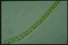 Spirogyra