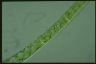 Spirogyra