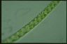 Spirogyra