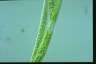 Euglena oxyuris