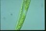 Euglena oxyuris