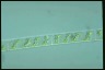 Spirogyra