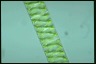 Spirogyra