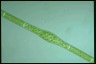 Spirogyra