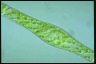 Spirogyra