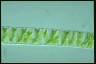 Spirogyra