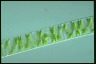 Spirogyra