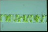 Spirogyra