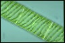 Spirogyra