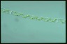 Spirogyra