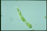 Euglena deses