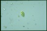 Euglena