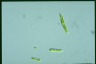 Euglena gracilis