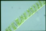 Spirogyra Rhizophydium