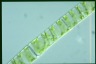 Spirogyra Rhizophydium