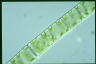 Spirogyra Rhizophydium