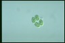 Glaucocystis nostochinearum