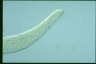 Spirostomum