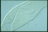 Spirostomum