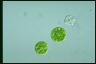 Asterococcus