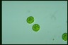 Asterococcus