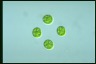 Asterococcus