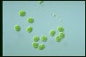 Asterococcus