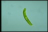 Euglena oxyuris