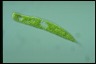 Euglena oxyuris