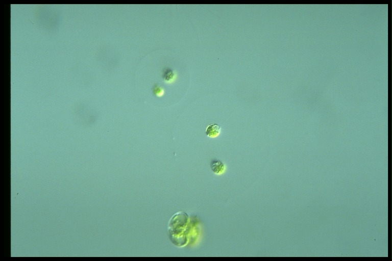 protist image