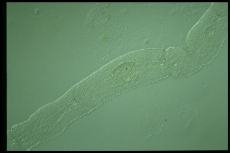 protist image