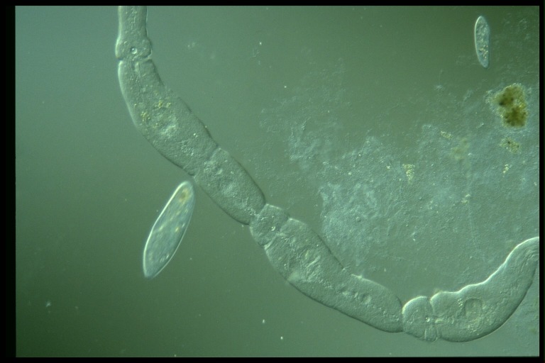 protist image