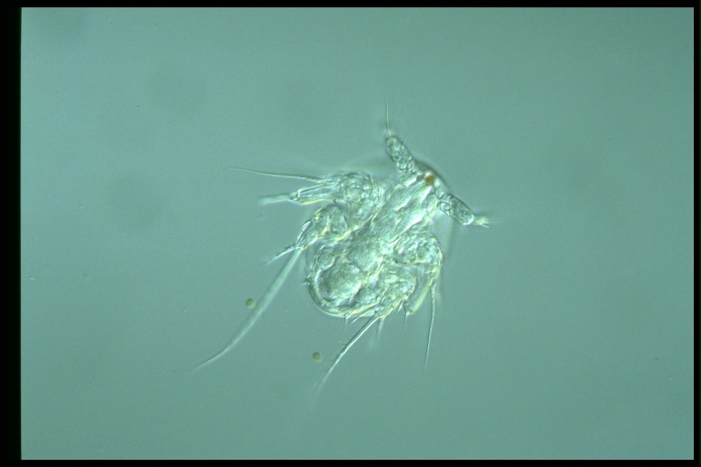 protist image