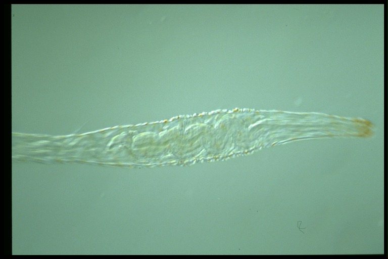 protist image