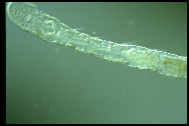 protist image