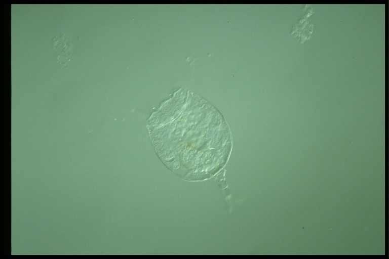 protist image