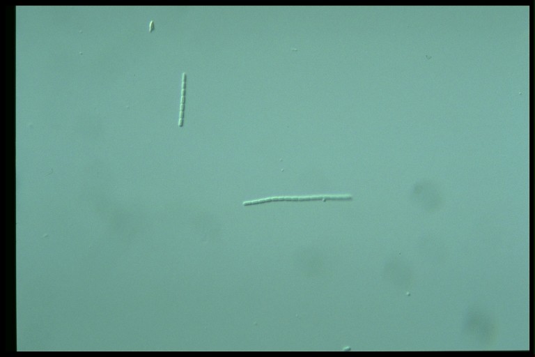 protist image