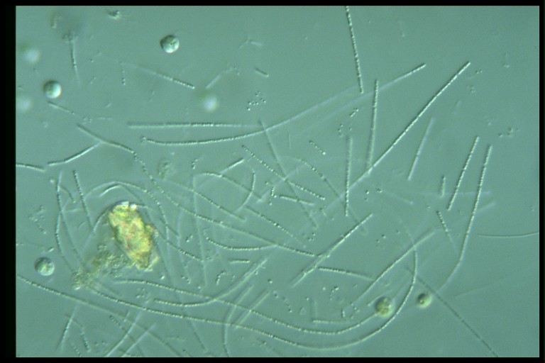 protist image